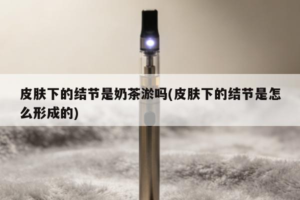 皮膚下的結節是奶茶煙嗎(皮膚下的結節是怎麼形成的)